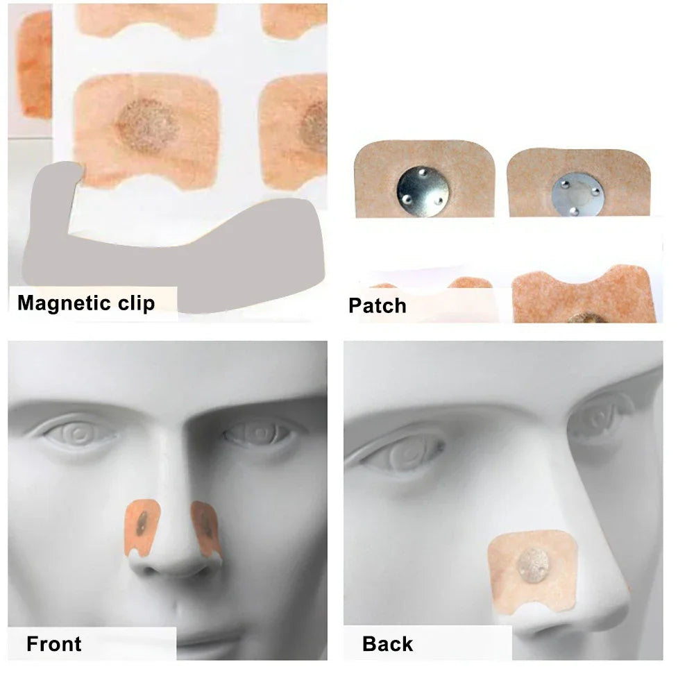 90-teiliges Nasenstreifen-Packung mit Anti-Schnarch-Nasendilatatoren, magnetische Nasenstreifen, Ansaug- und Atemgeräte
